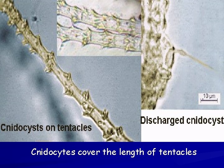 Cnidocytes cover the length of tentacles Cnidocytes cover the length of tentacles