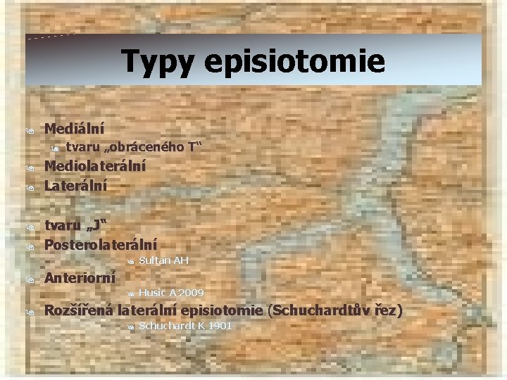 Typy episiotomie 9 Mediální 9 9 9 9 tvaru „obráceného T“ Mediolaterální Laterální tvaru