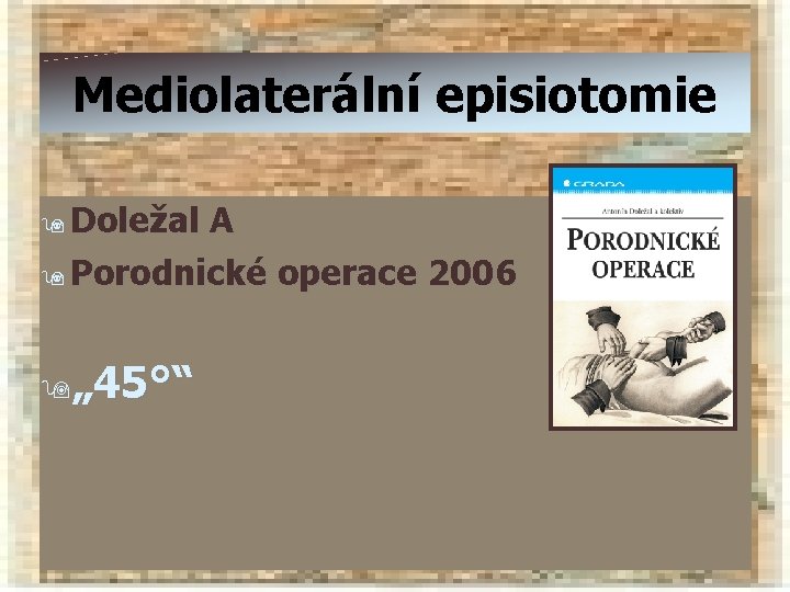 Mediolaterální episiotomie 9 Doležal A 9 Porodnické operace 2006 9„ 45°“ 