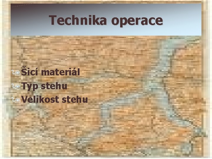 Technika operace 9Šicí materiál 9 Typ stehu 9 Velikost stehu 