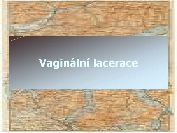 Vaginální lacerace 