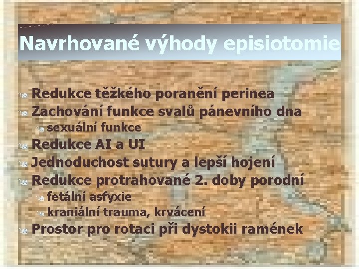 Navrhované výhody episiotomie Redukce těžkého poranění perinea 9 Zachování funkce svalů pánevního dna 9