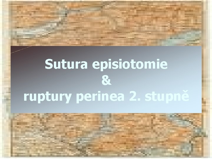 Sutura episiotomie & ruptury perinea 2. stupně 