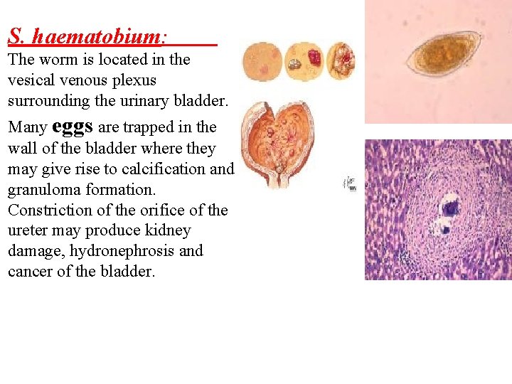 S. haematobium: The worm is located in the vesical venous plexus surrounding the urinary