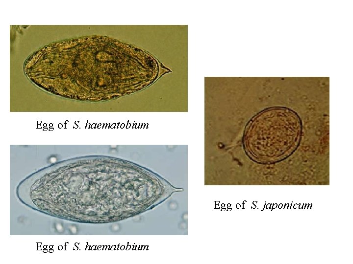 Egg of S. haematobium Egg of S. japonicum Egg of S. haematobium 