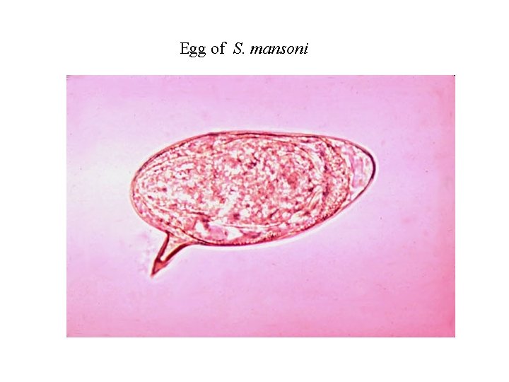 Egg of S. mansoni 