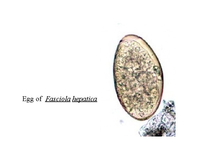 Egg of Fasciola hepatica 