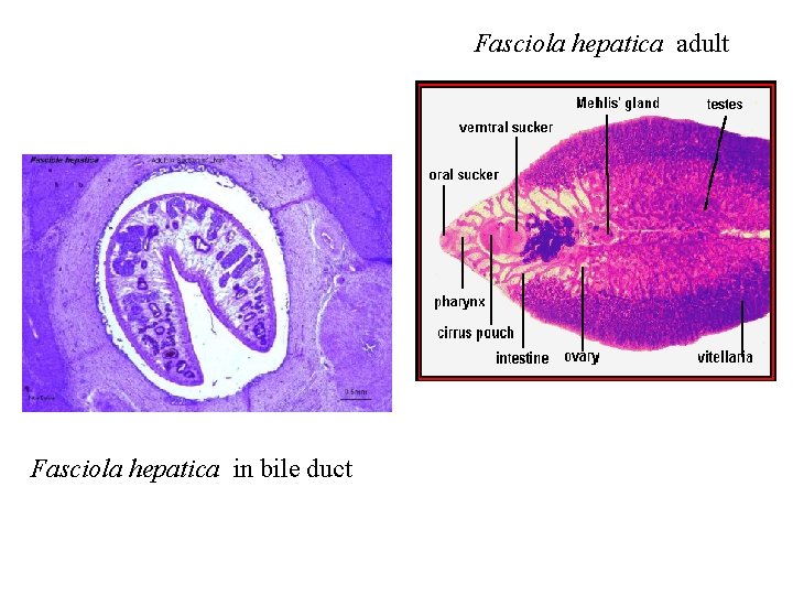 Fasciola hepatica adult Fasciola hepatica in bile duct 