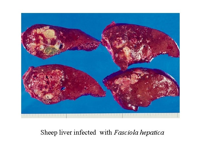 Sheep liver infected with Fasciola hepatica 