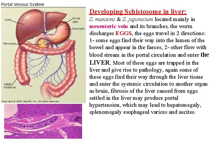 Developing Schistosome in liver: S. mansoni & S. japonicum located mainly in mesenteric vein