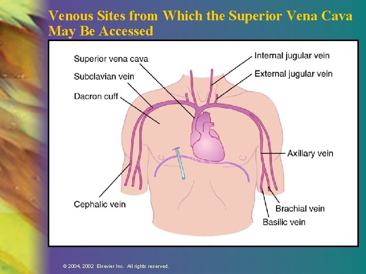 Venous Sites from Which the Superior Vena Cava May Be Accessed © 2004, 2002