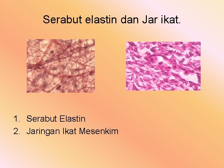 Serabut elastin dan Jar ikat. 1. Serabut Elastin 2. Jaringan Ikat Mesenkim 