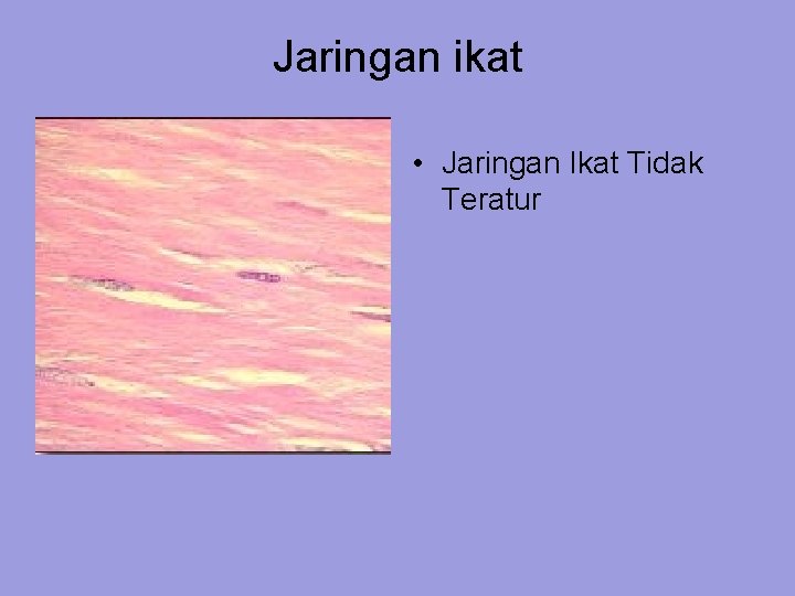 Jaringan ikat • Jaringan Ikat Tidak Teratur 