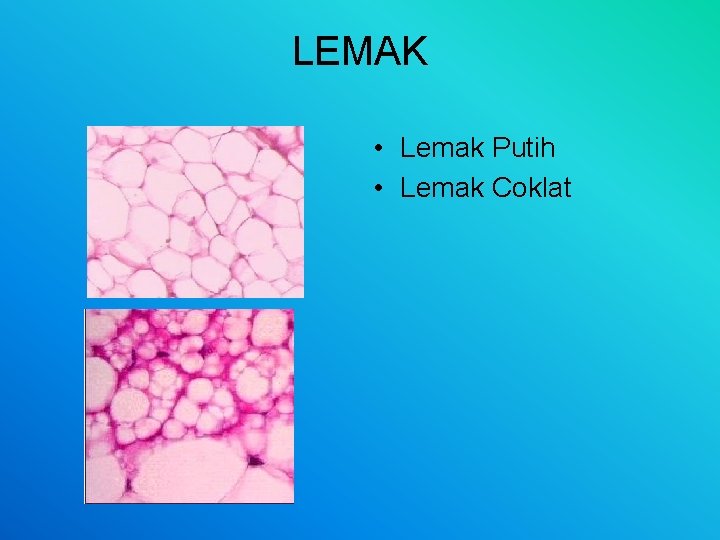 LEMAK • Lemak Putih • Lemak Coklat 