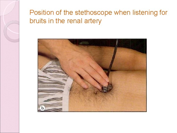 Position of the stethoscope when listening for bruits in the renal artery 