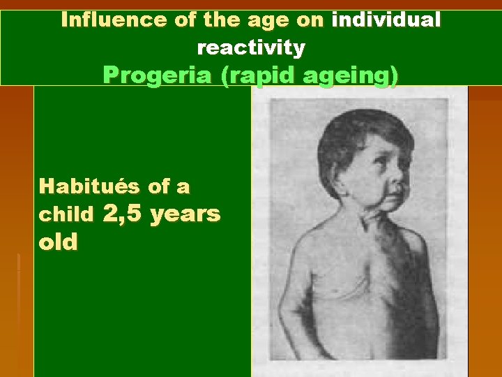 Influence of the age on individual reactivity Progeria (rapid ageing) Habitués of a child