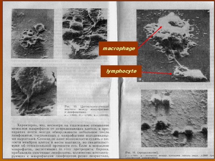 macrophage lymphocyte 