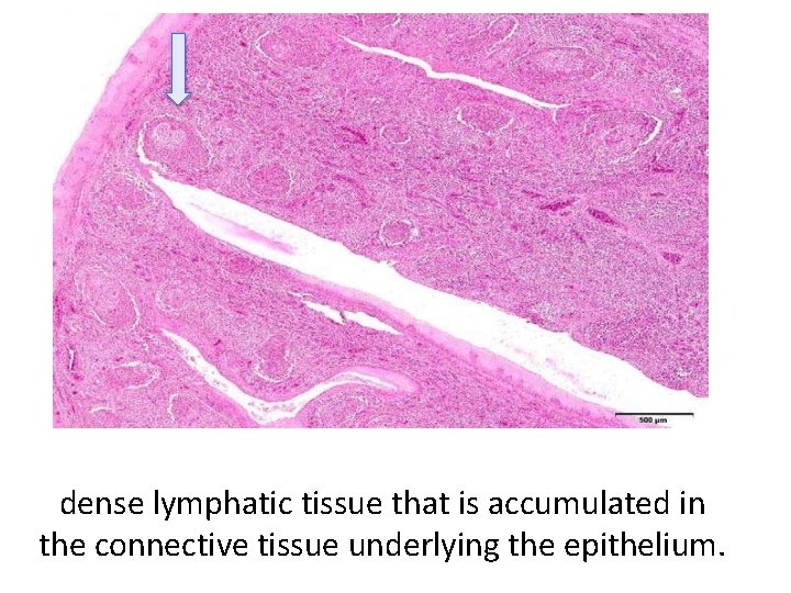 dense lymphatic tissue that is accumulated in the connective tissue underlying the epithelium. 