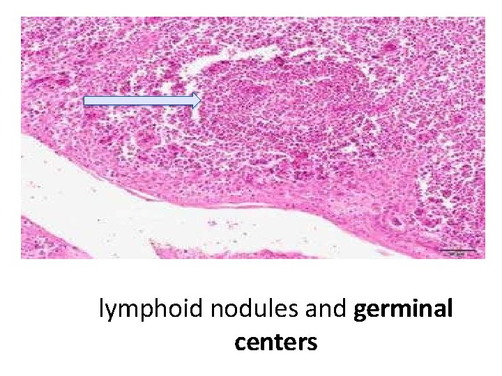 lymphoid nodules and germinal centers 