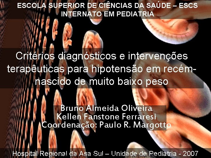 ESCOLA SUPERIOR DE CIÊNCIAS DA SAÚDE – ESCS INTERNATO EM PEDIATRIA Critérios diagnósticos e