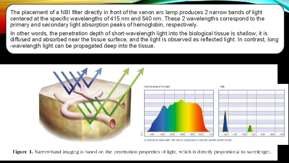 The placement of a NBI filter directly in front of the xenon arc lamp
