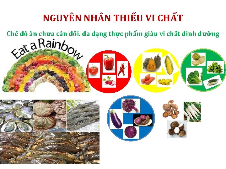 NGUYÊN NH N THIẾU VI CHẤT Chế độ ăn chưa cân đối, đa dạng