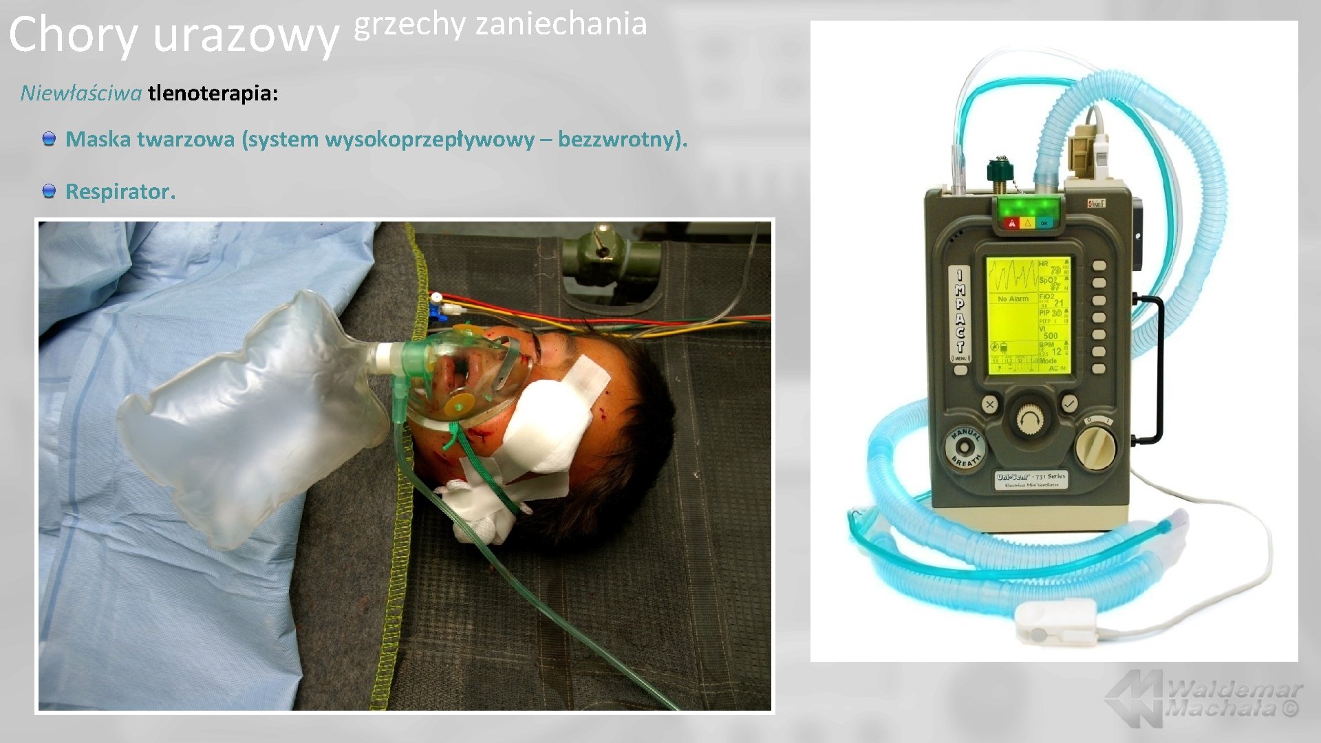 Chory urazowy grzechy zaniechania Niewłaściwa tlenoterapia: Maska twarzowa (system wysokoprzepływowy – bezzwrotny). Respirator. 