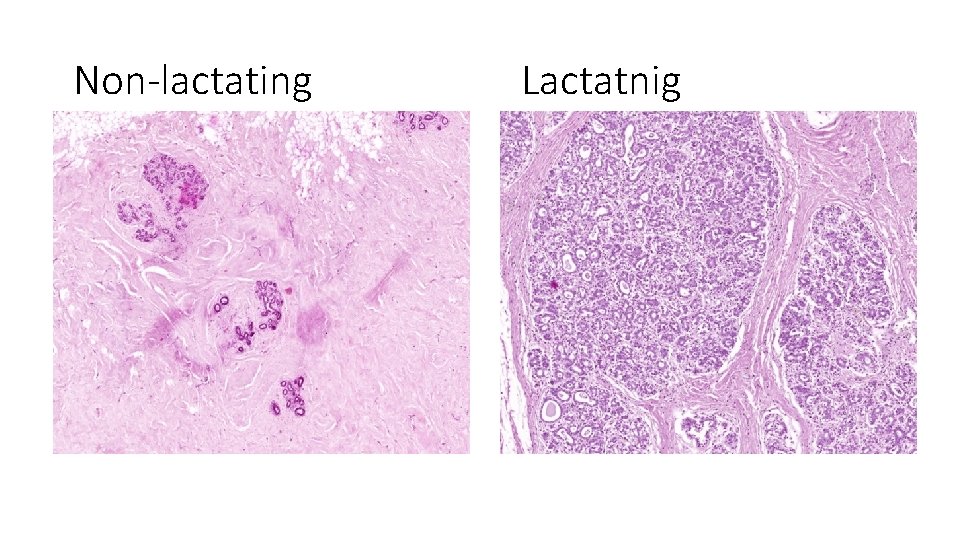 Non-lactating Lactatnig 