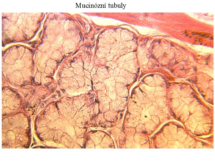 Mucinózní tubuly 