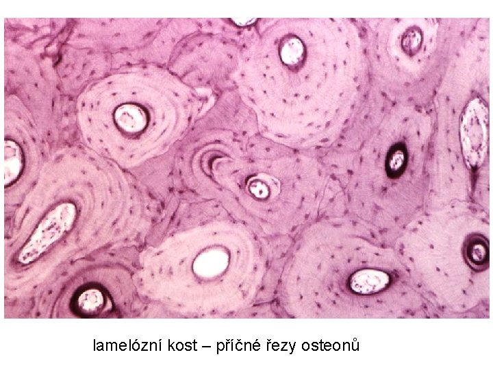 lamelózní kost – příčné řezy osteonů lamelózní kost – příčné řezy osteonů