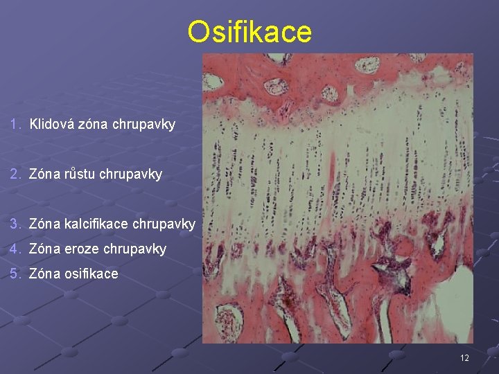 Osifikace 1. Klidová zóna chrupavky 2. Zóna růstu chrupavky 3. Zóna kalcifikace chrupavky 4.