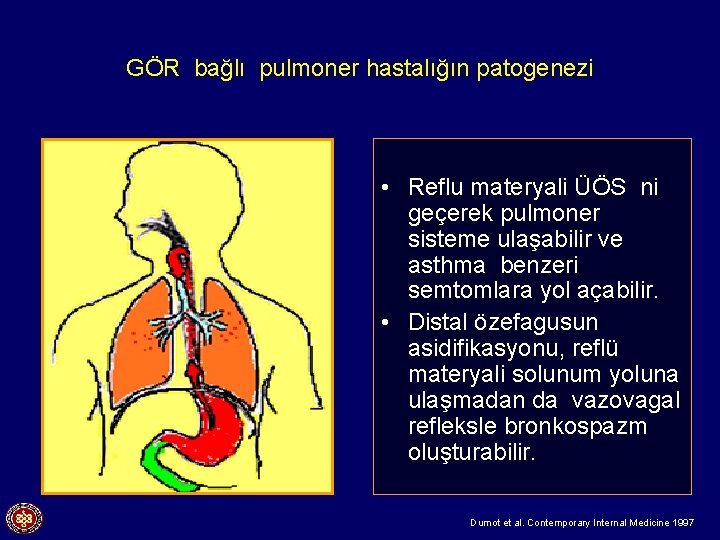 GÖR bağlı pulmoner hastalığın patogenezi • Reflu materyali ÜÖS ni geçerek pulmoner sisteme ulaşabilir