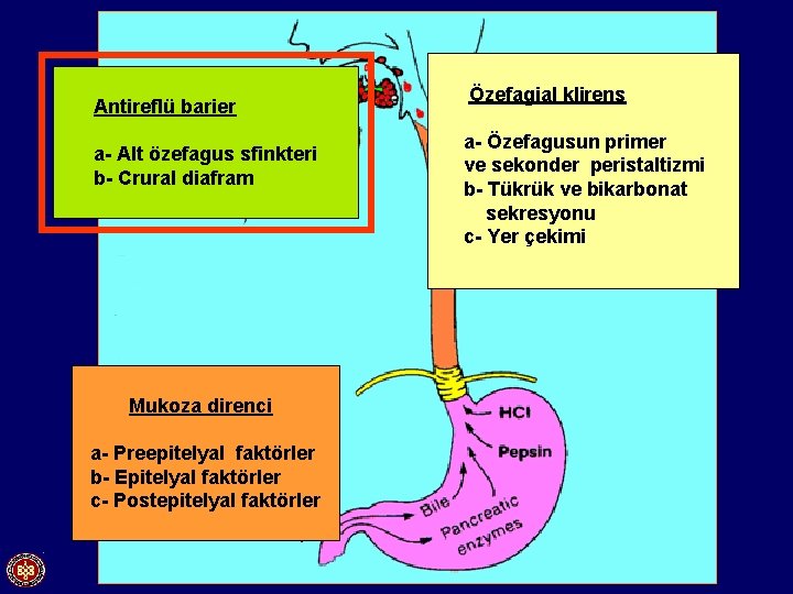 Antireflü barier a- Alt özefagus sfinkteri b- Crural diafram Mukoza direnci a- Preepitelyal faktörler