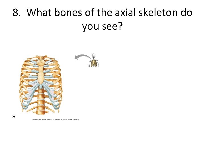 8. What bones of the axial skeleton do you see? 