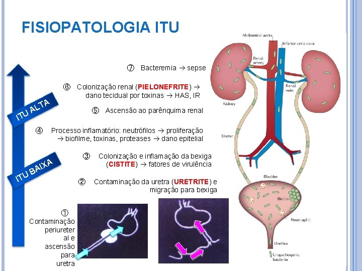 FISIOPATOLOGIA ITU ⑦ Bacteremia sepse ⑥ Colonização renal (PIELONEFRITE) dano tecidual por toxinas HAS,