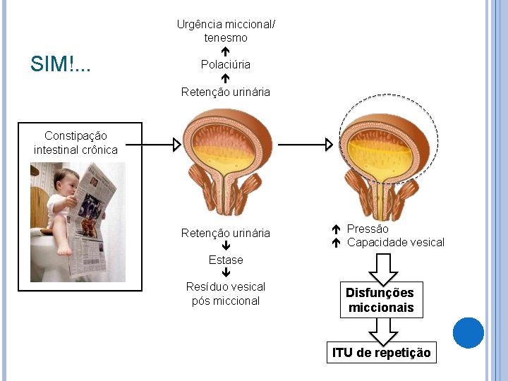 SIM!. . . Urgência miccional/ tenesmo Polaciúria Retenção urinária Constipação intestinal crônica Retenção urinária