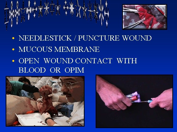  • NEEDLESTICK / PUNCTURE WOUND • MUCOUS MEMBRANE • OPEN WOUND CONTACT WITH