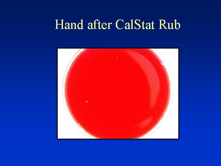 Hand after Cal. Stat Rub 