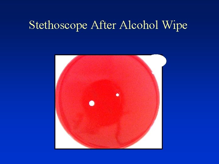 Stethoscope After Alcohol Wipe 