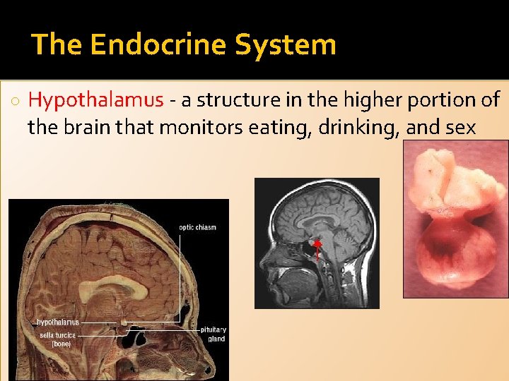 The Endocrine System ○ Hypothalamus - a structure in the higher portion of the