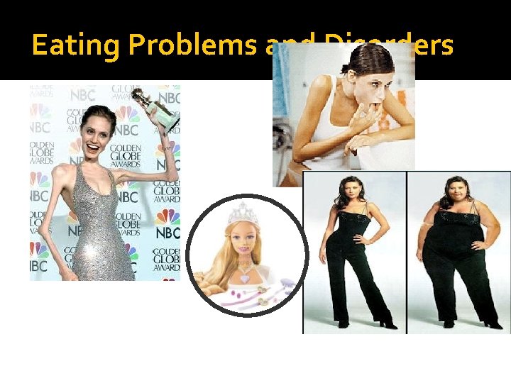 Eating Problems and Disorders 