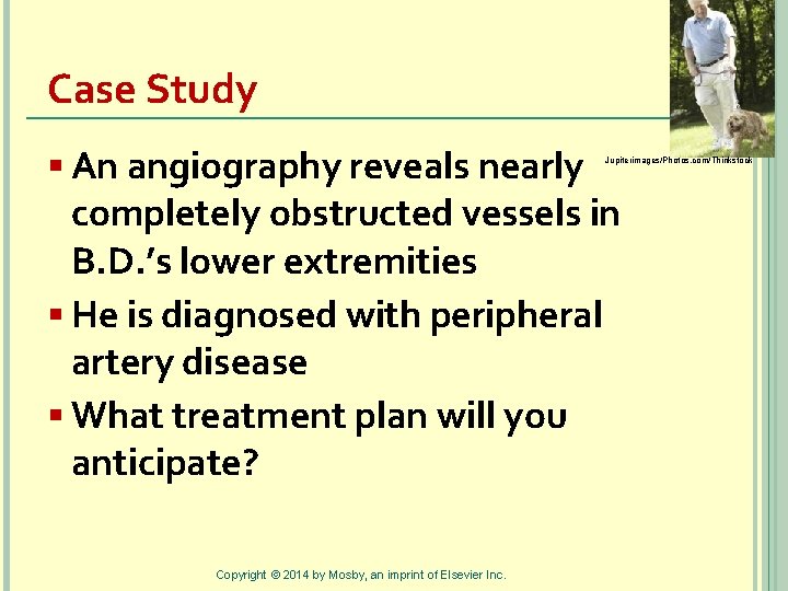 Case Study § An angiography reveals nearly Jupiterimages/Photos. com/Thinkstock completely obstructed vessels in B.