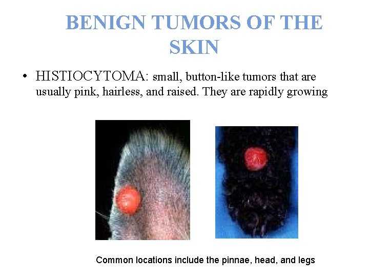 BENIGN TUMORS OF THE SKIN • HISTIOCYTOMA: small, button-like tumors that are usually pink,