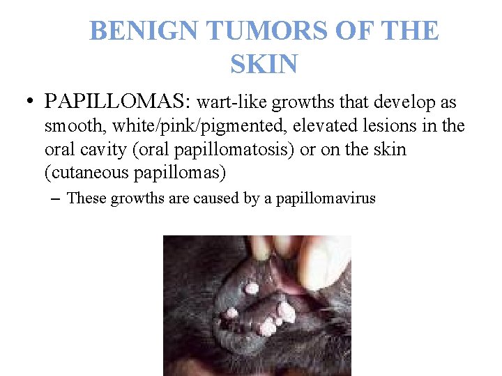 BENIGN TUMORS OF THE SKIN • PAPILLOMAS: wart-like growths that develop as smooth, white/pink/pigmented,