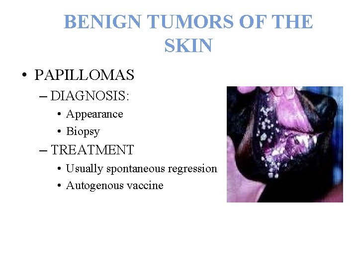 BENIGN TUMORS OF THE SKIN • PAPILLOMAS – DIAGNOSIS: • Appearance • Biopsy –