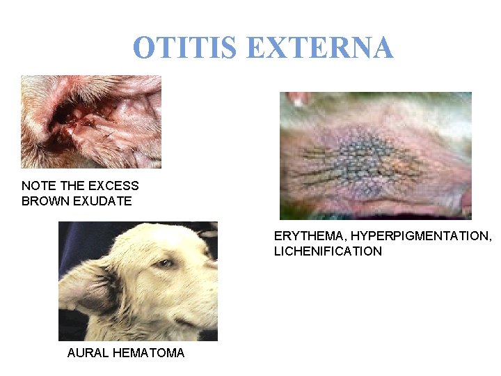 OTITIS EXTERNA NOTE THE EXCESS BROWN EXUDATE ERYTHEMA, HYPERPIGMENTATION, LICHENIFICATION AURAL HEMATOMA 