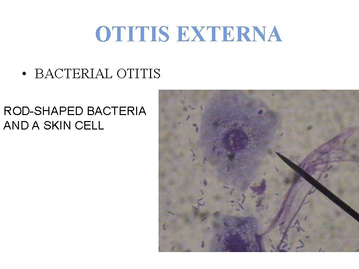 OTITIS EXTERNA • BACTERIAL OTITIS ROD-SHAPED BACTERIA AND A SKIN CELL 