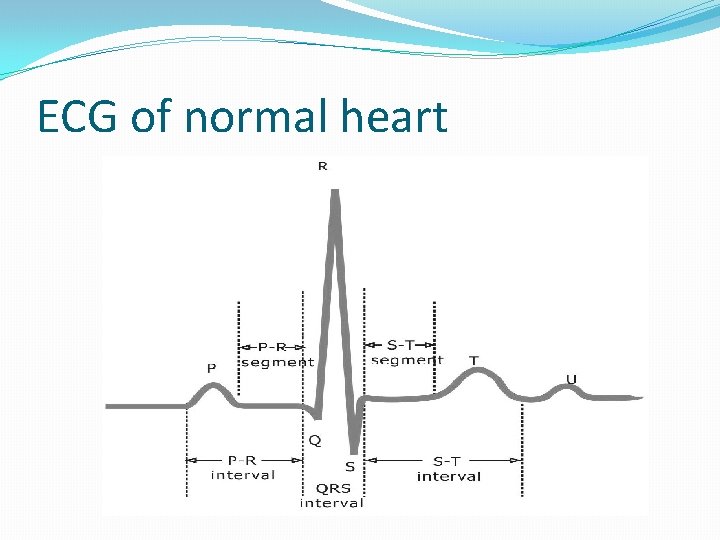 ECG of normal heart 