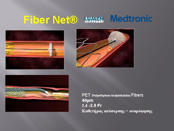 Fiber Net® PET (Polyethylene terephthalate) Fibers 40µm 2. 4 -2. 9 Fr Καθετήρας απόσυρσης