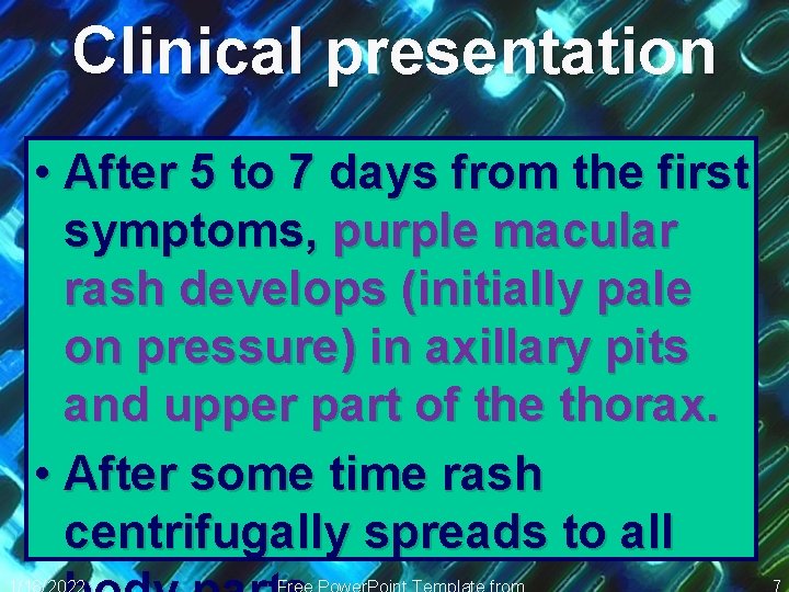 Clinical presentation • After 5 to 7 days from the first symptoms, purple macular